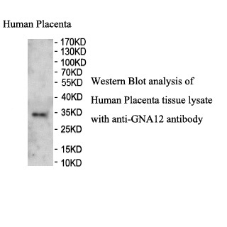GNA12 antibody (pAb)