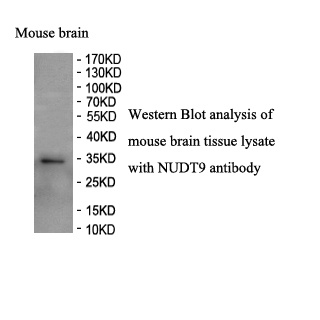 NUDT9 antibody (pAb) NUDT9 antibody (pAb)