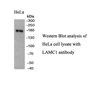 LAMC1 antibody (pAb) LAMC1 antibody (pAb)