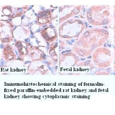 CASP3 antibody (pAb) CASP3 antibody (pAb)