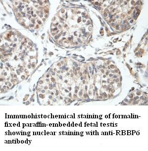 RBBP6 antibody (pAb) RBBP6 antibody (pAb)