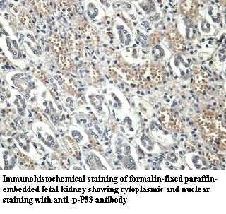 p-P53 (phospho S15) antibody (pAb) p-P53 (phospho S15) antibody (pAb)