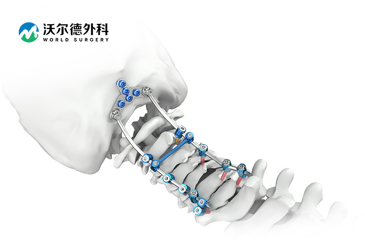 颈椎后路内固定系统