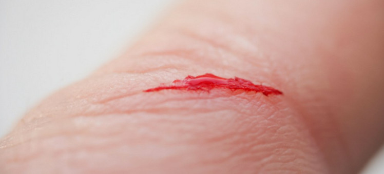 Skin wound adhesive