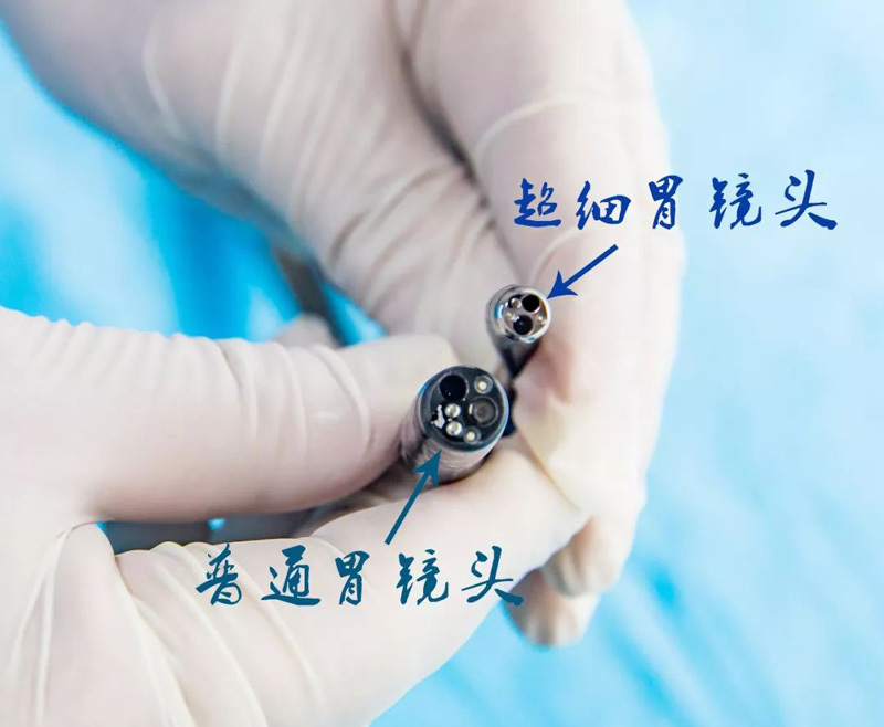 双镜突破：从肿瘤毫米级切除到儿童无痛胃镜——精准与舒适并行的医疗革新