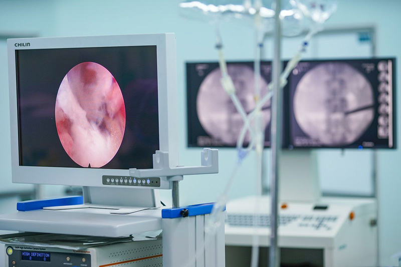 What is the price range of endoscopes and what factors influence it?