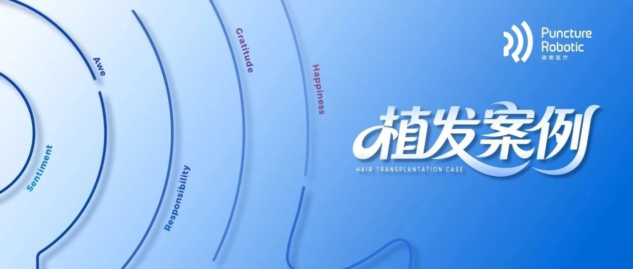 植发案例02 | HAIRO植发手术机器人用AI科技战胜“遗传性脱发”