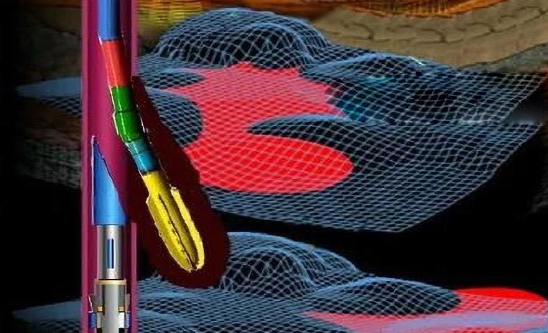 CNPC Changqing Oilfield Wushenqi block, Sudong 15-36H обработка аварийной скважины