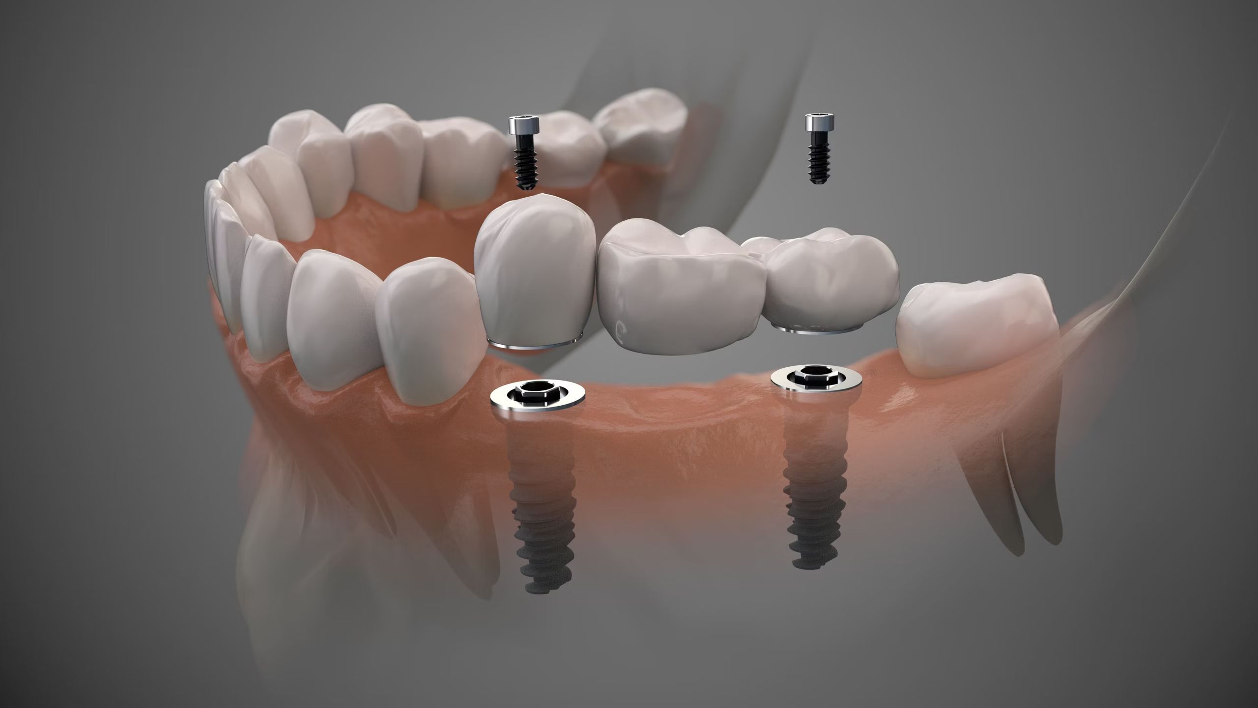 A Complete Guide to Photopolymerization 3D Printing Technologies and Applications(Part 4)
