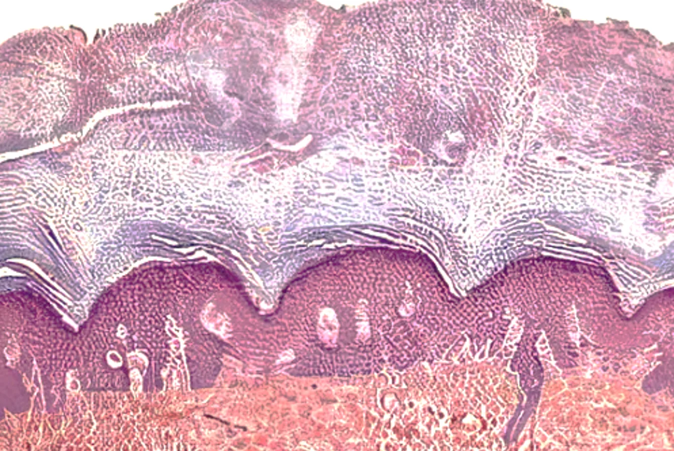 表皮微结构 Epidermis 表皮微结构 Epidermis