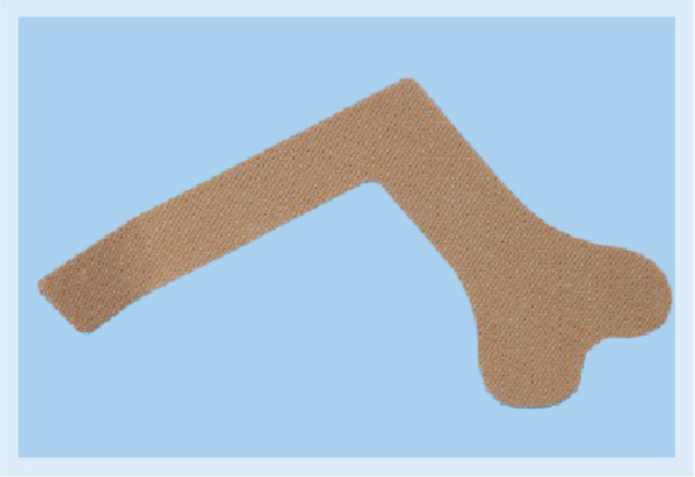 Mononasal feeding tube fixation - L-type 2