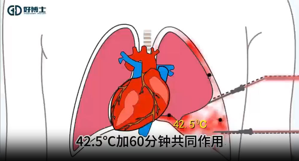 Good Doctor - Hot Infusion Animation Good Doctor - Hot Infusion Animation