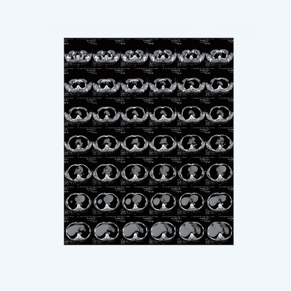 Medical Thermal Film H600