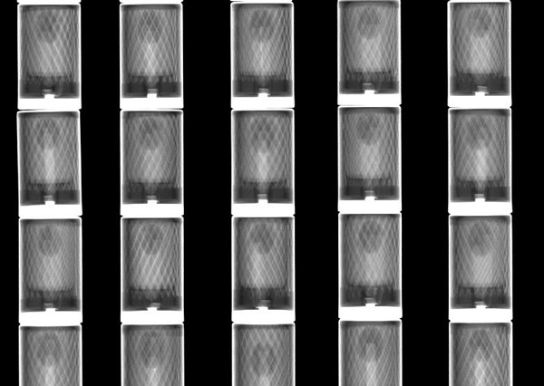 X-ray