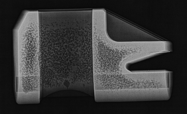 X-ray