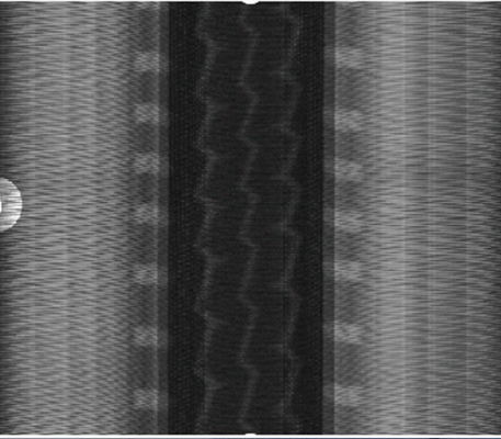 Example of Non-standard Machine - tire X-ray Defect Identification