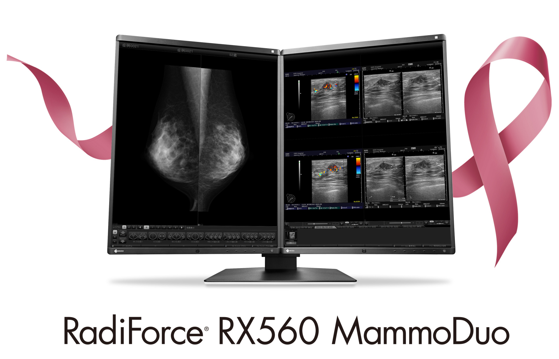 RX560