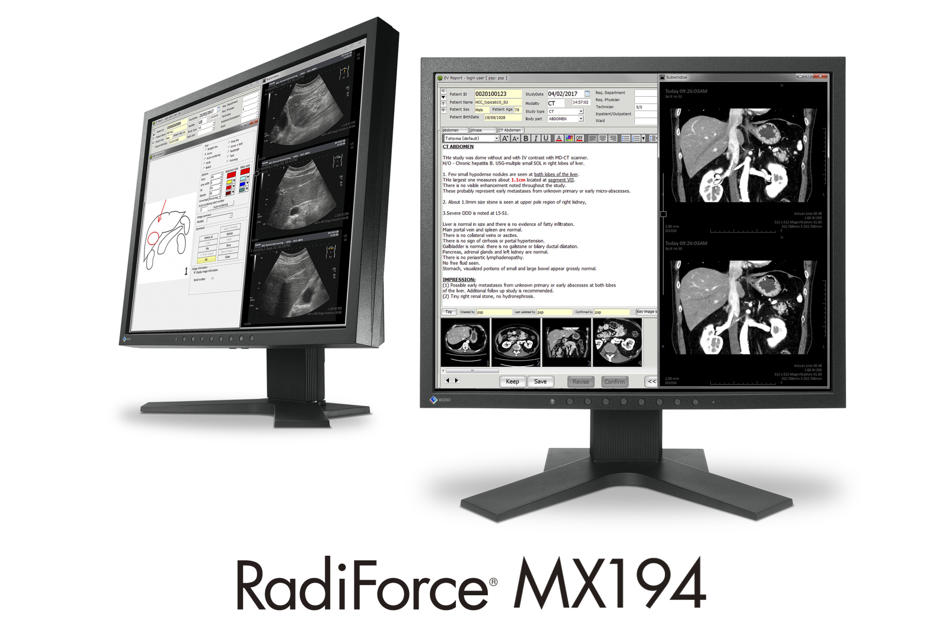 MX194