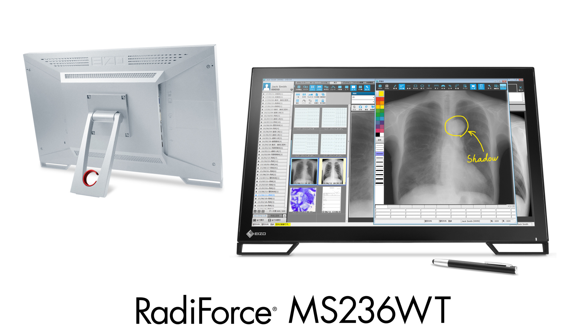 MS236WT