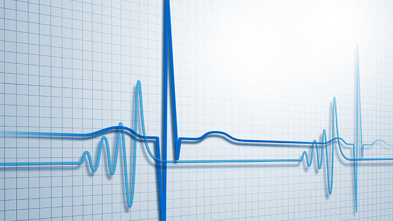 Electrophysiology