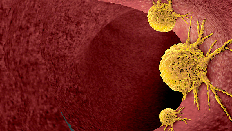 Oncology