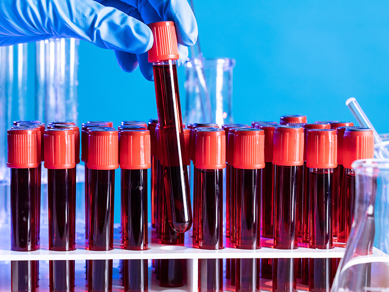 Technical characteristics of in vitro high throughput drug screening service for PDC model