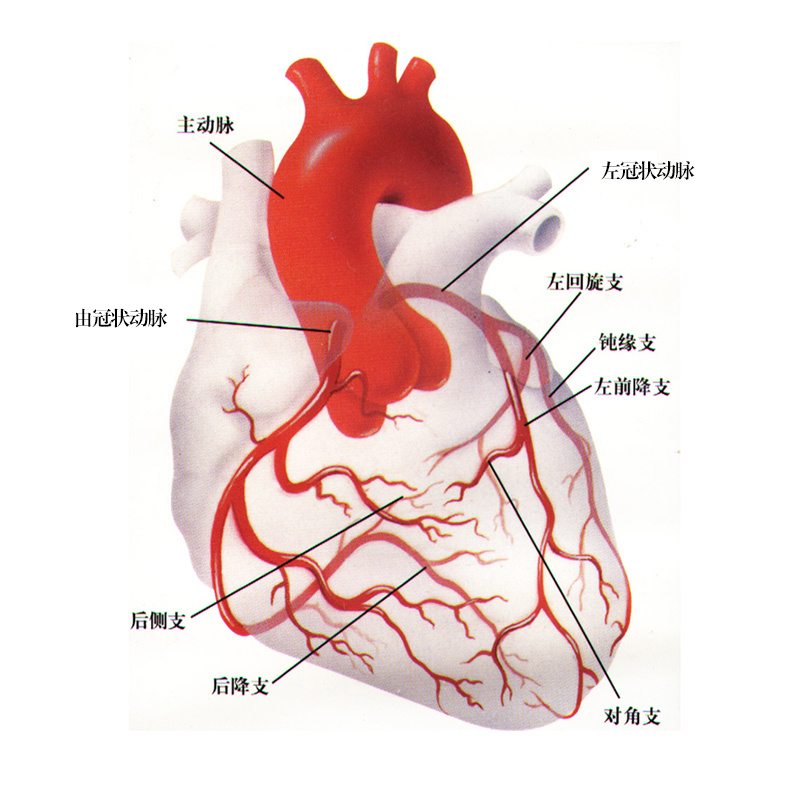 Latest PCI Guidelines Recommend IABP—Are You Using It Correctly?
