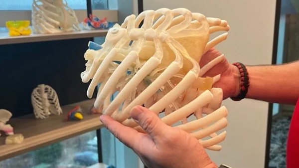 三维重构生命密码：3D打印技术开启精准手术规划新纪元