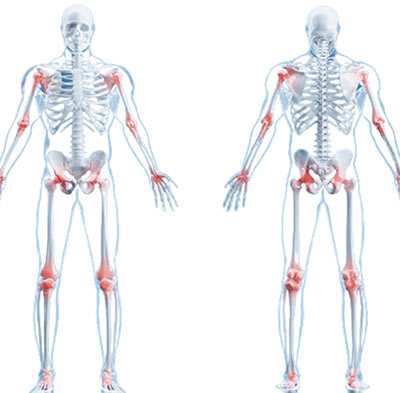 Skeleton