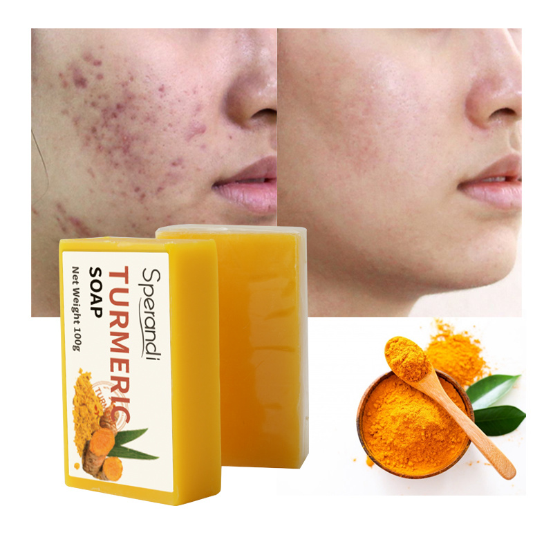Turmeric Soap Turmeric Soap