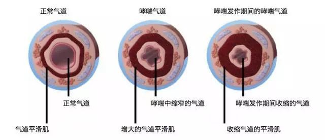 热金属喷涂粉尘污染