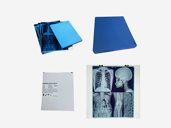 Medical Inkjet Blue X Ray Film