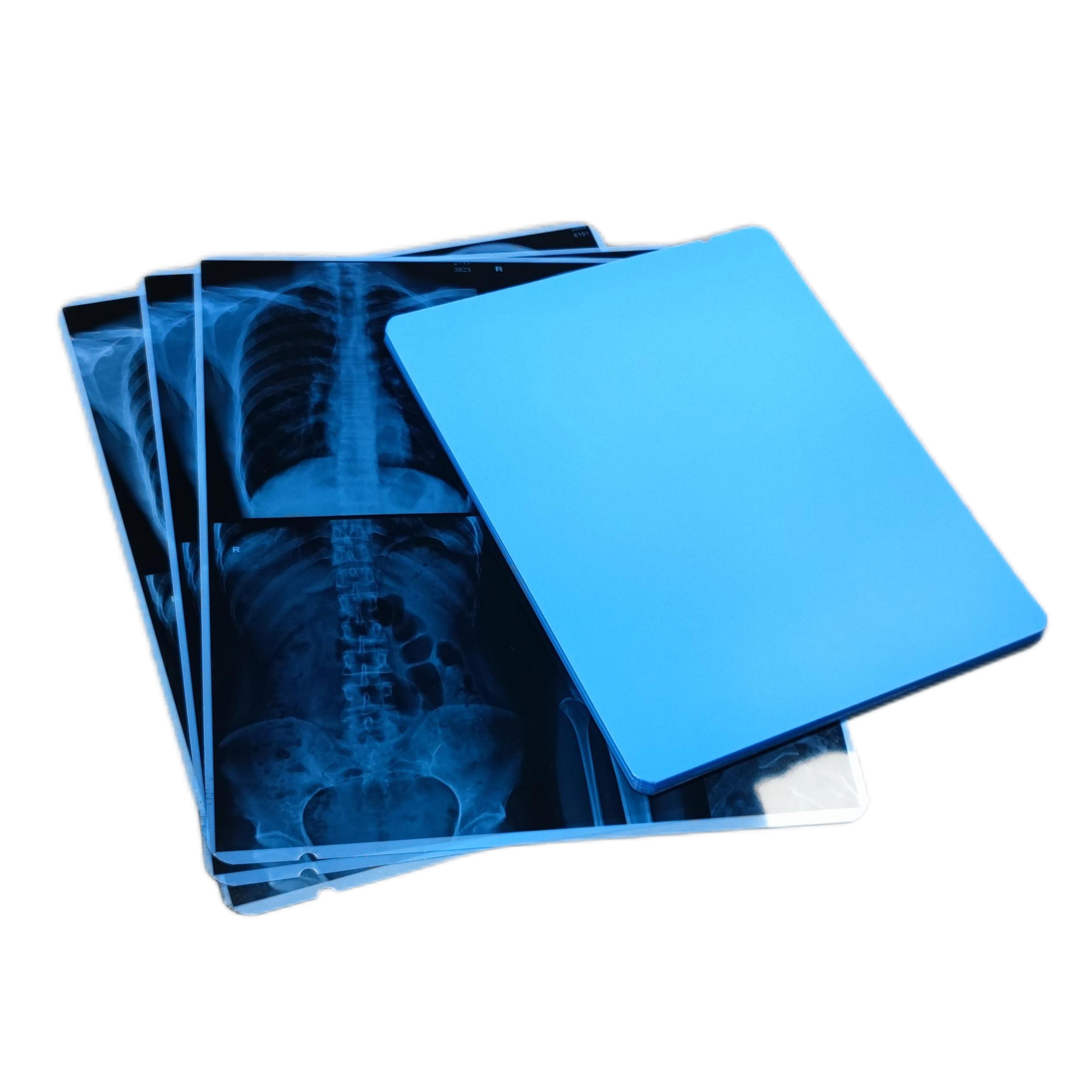 China Best Quality Medical Inkjet Blue X Ray Film 210mic for DR, CT, MRI x ray department.