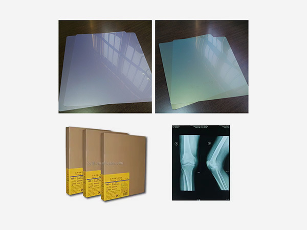 Medical Blue Green Sensitive X-Ray Film