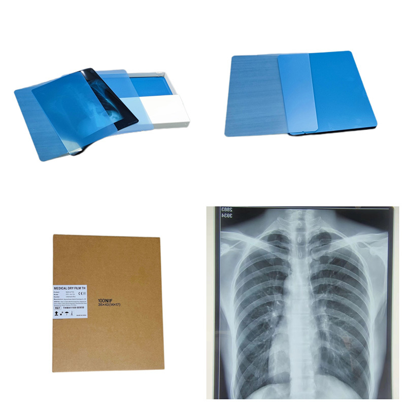 Medical Thermal X Ray Film for fuji drypix 2000/lite, 3500 printer.