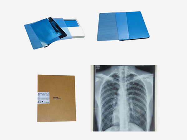 Medical Thermal X Ray Film