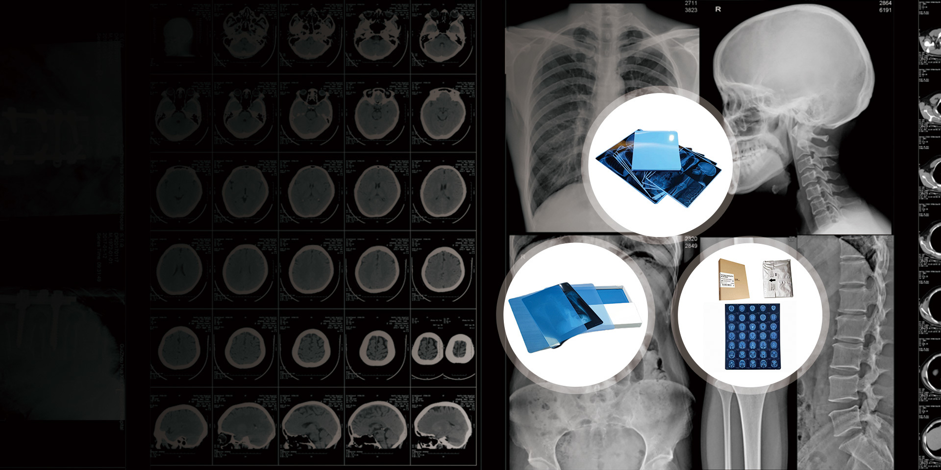 Focusing on providing a one-stop solution for medical film
