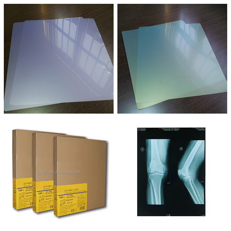Medical Blue/Green Sensitive X-Ray film