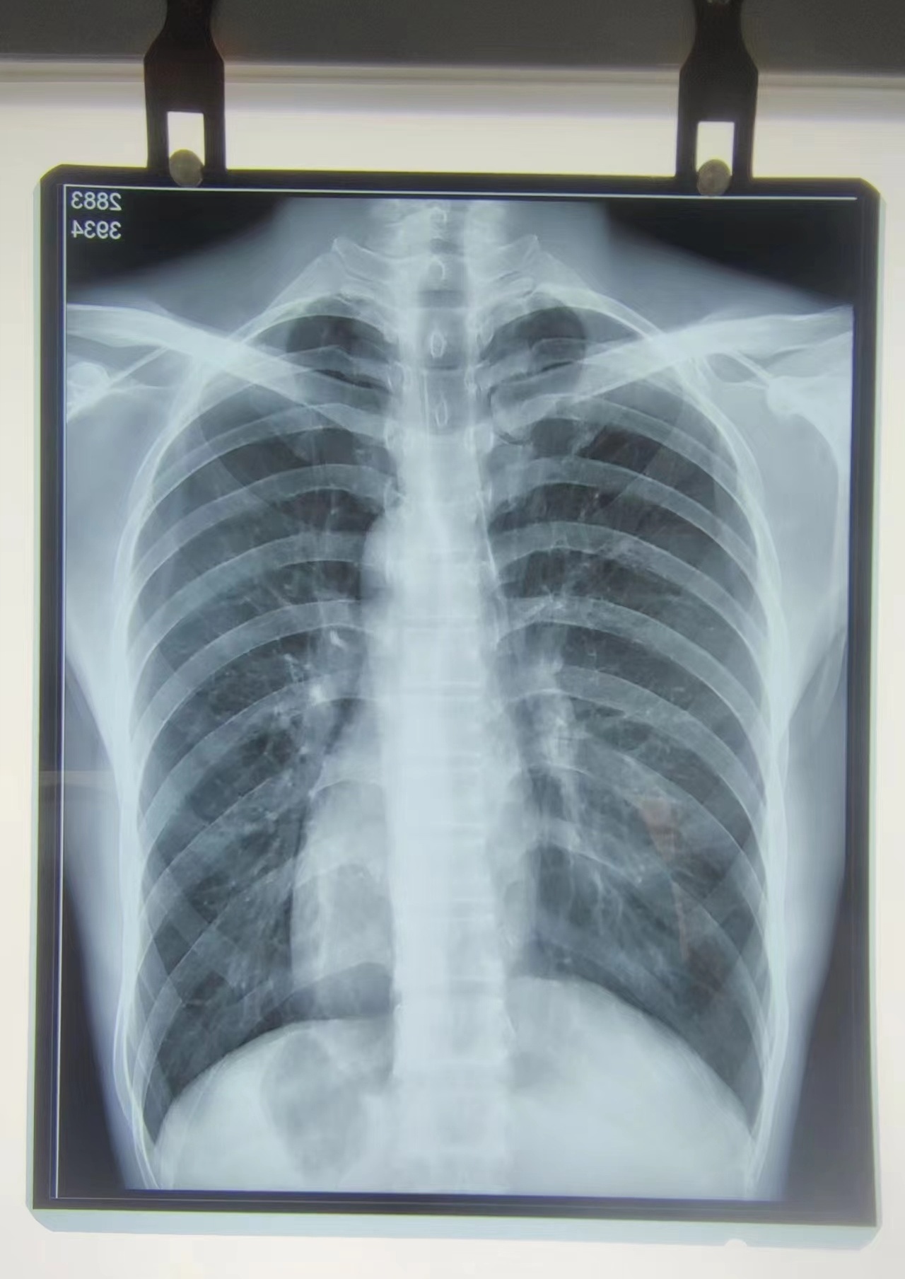 Fuji DI-HT Medical Thermal Film DR CT MRI best quality Imaging Suitable for Fuji 2000/lite Printers