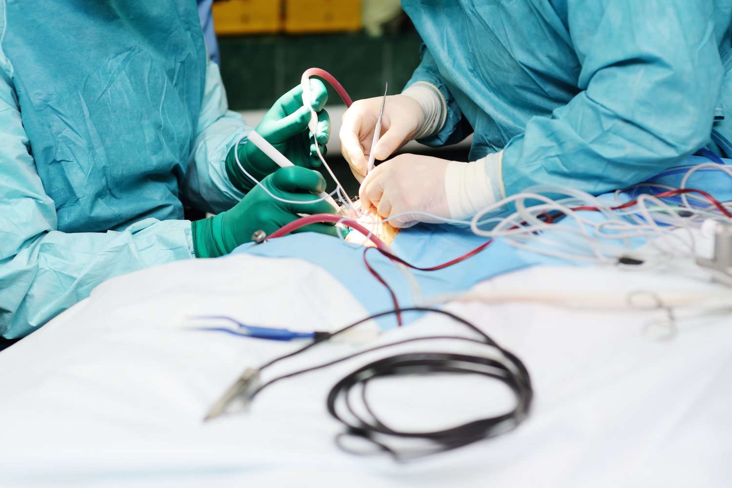 Ultra-Fine 0.025 mm Pure Nickel Wire: Key Material for Micro-Welding and High-Reliability Electronics