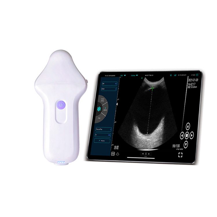 USB&Wifi Ophthalmic Color Doppler Ultrasonic