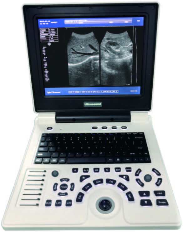 S30B Laptop Full Digital Diagnostic System