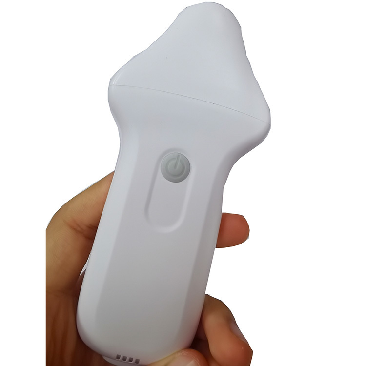 USB&Wifi Ophthalmic Color Doppler Ultrasonic