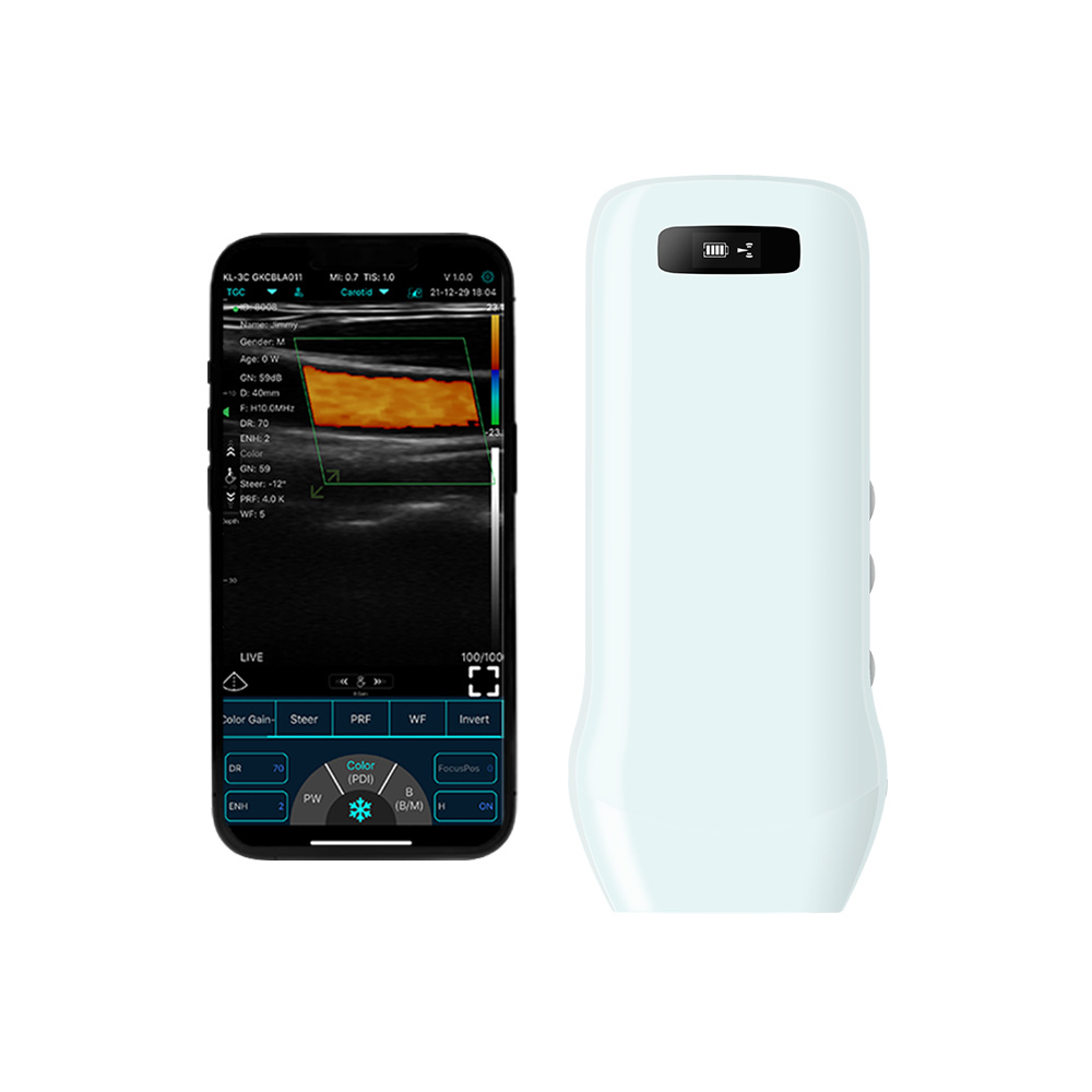 192E Wireless linear color Doppler ultrasound