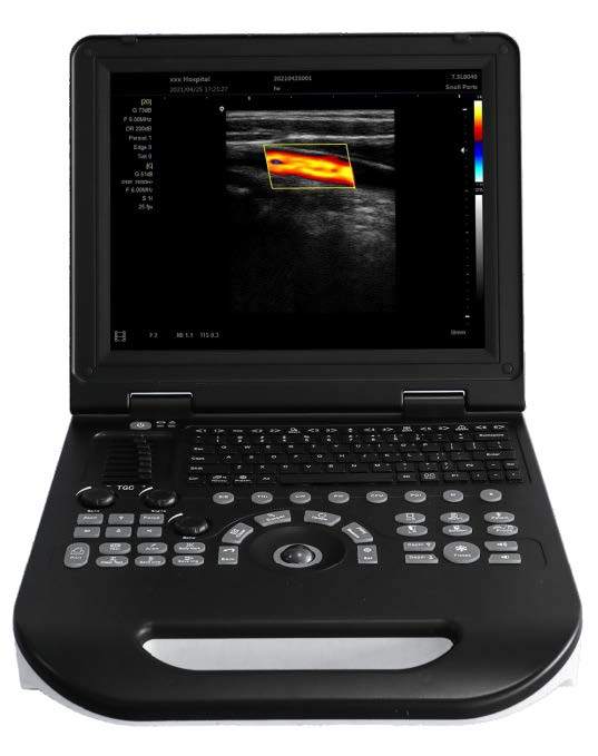 E30 Color Doppler Ultrasound Diagnostic System