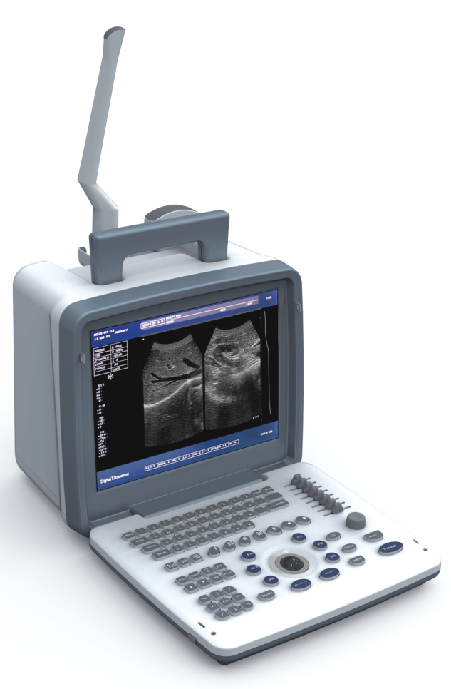 S300 Full Digital Ultrasound Diagnostic System