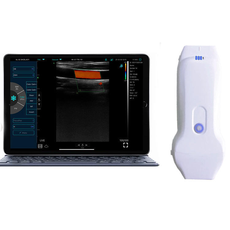 Handheld dual probe Color Ultrasound