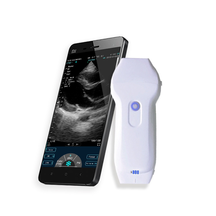 Handheld dual probe Color Ultrasound