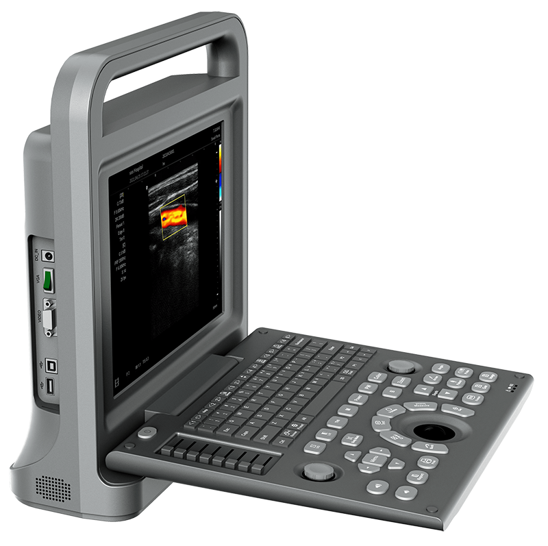 E90 Color Doppler Ultrasound Diagnostic System