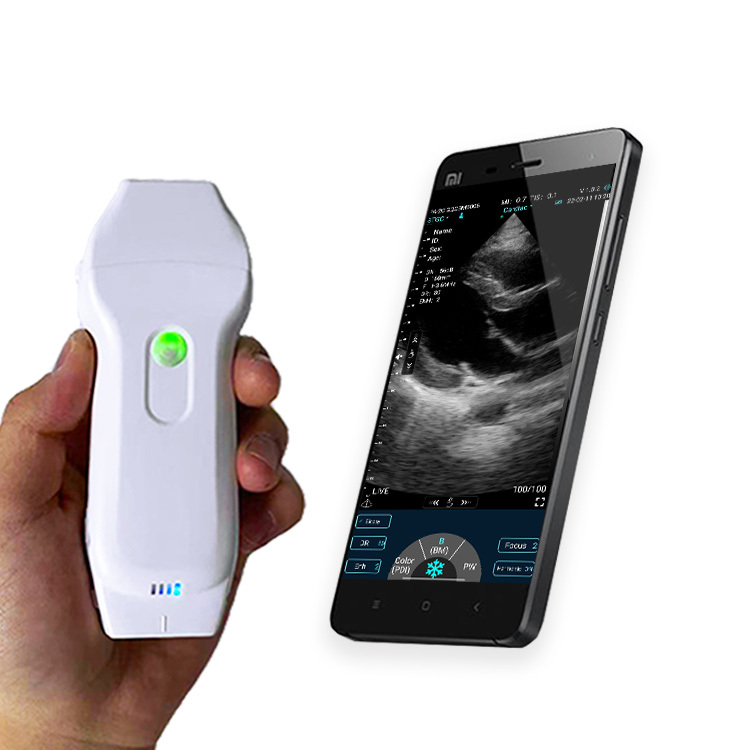 Handheld dual probe Color Ultrasound